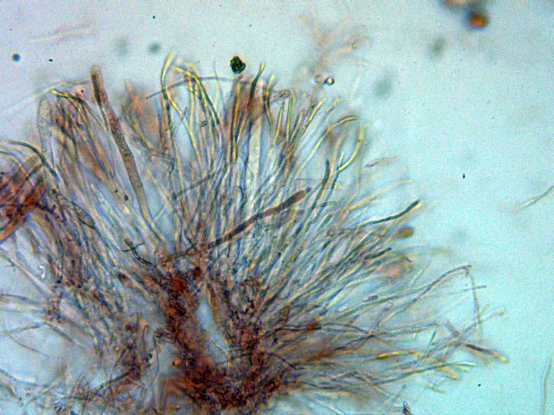 Calycina claroflava 10 - Himenio x 400 2